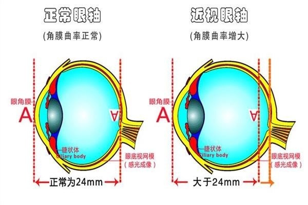 博視頓視力康復(fù)中心加盟